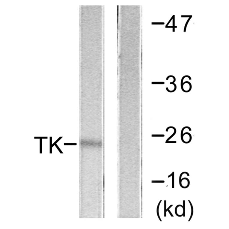 Western Blot - Anti-TK Antibody (B0586) - Antibodies.com