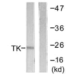 Western Blot - Anti-TK Antibody (B0586) - Antibodies.com