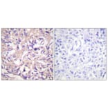 Immunohistochemistry - Anti-TK Antibody (B0586) - Antibodies.com