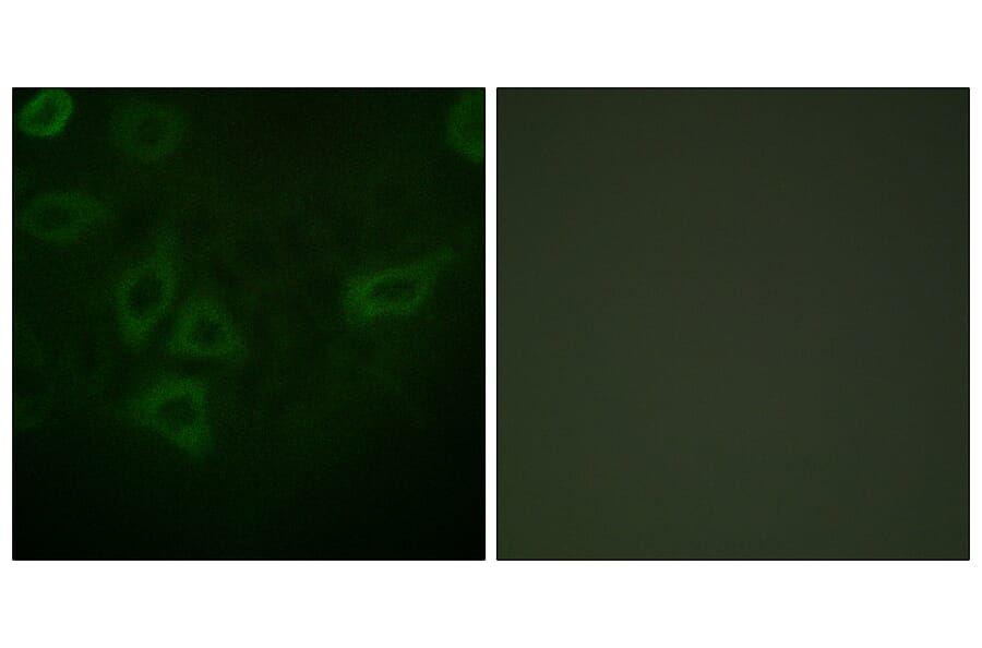 Immunofluorescence - Anti-TK Antibody (B0586) - Antibodies.com