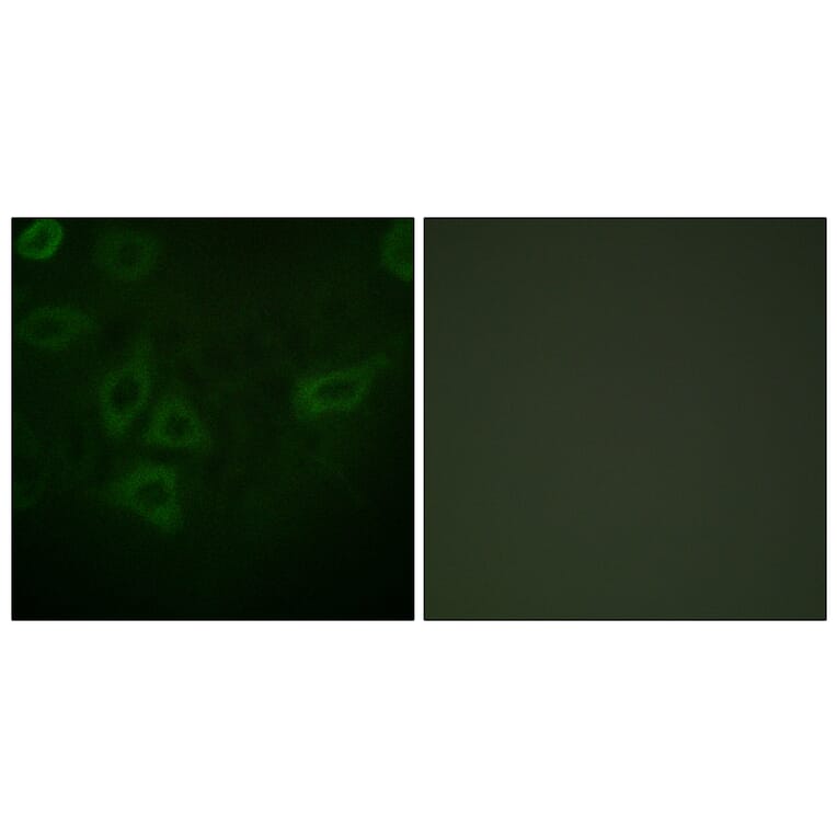 Immunofluorescence - Anti-TK Antibody (B0586) - Antibodies.com