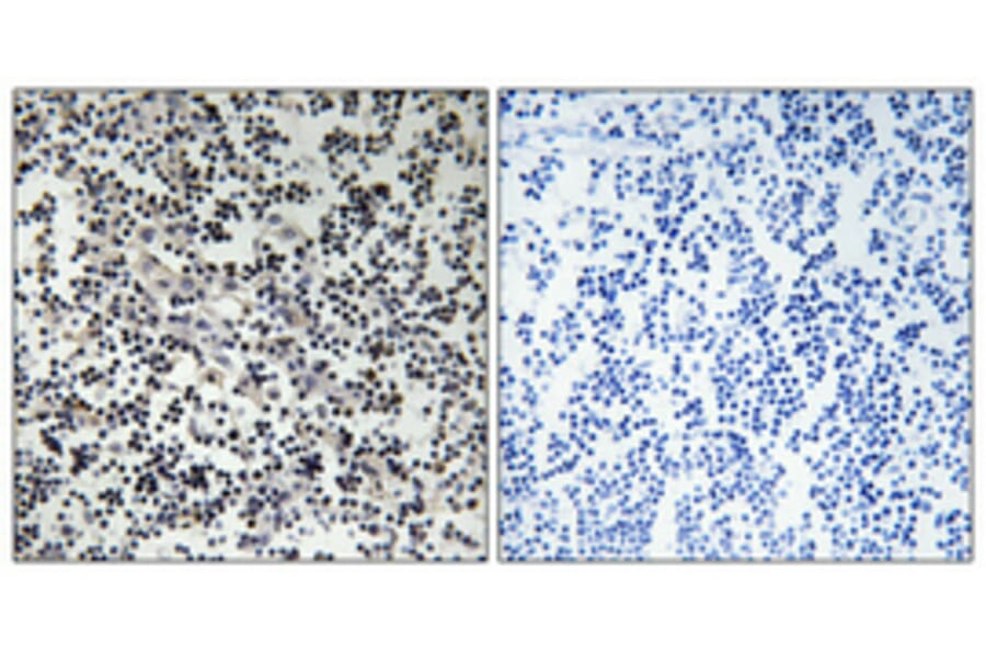 Immunohistochemistry - Anti-TK Antibody (B0586) - Antibodies.com