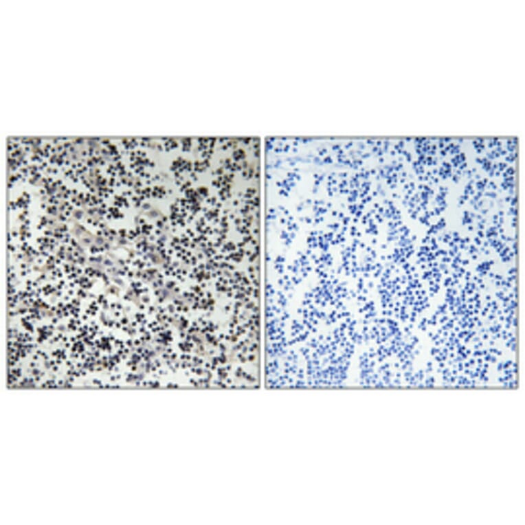 Immunohistochemistry - Anti-TK Antibody (B0586) - Antibodies.com