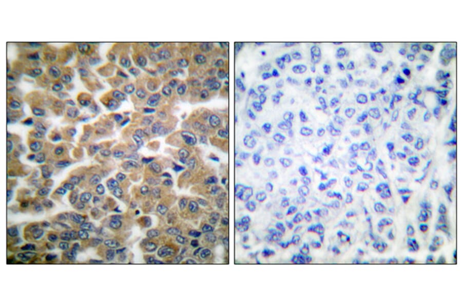 Immunohistochemistry - Anti-GR Antibody (B0073) - Antibodies.com