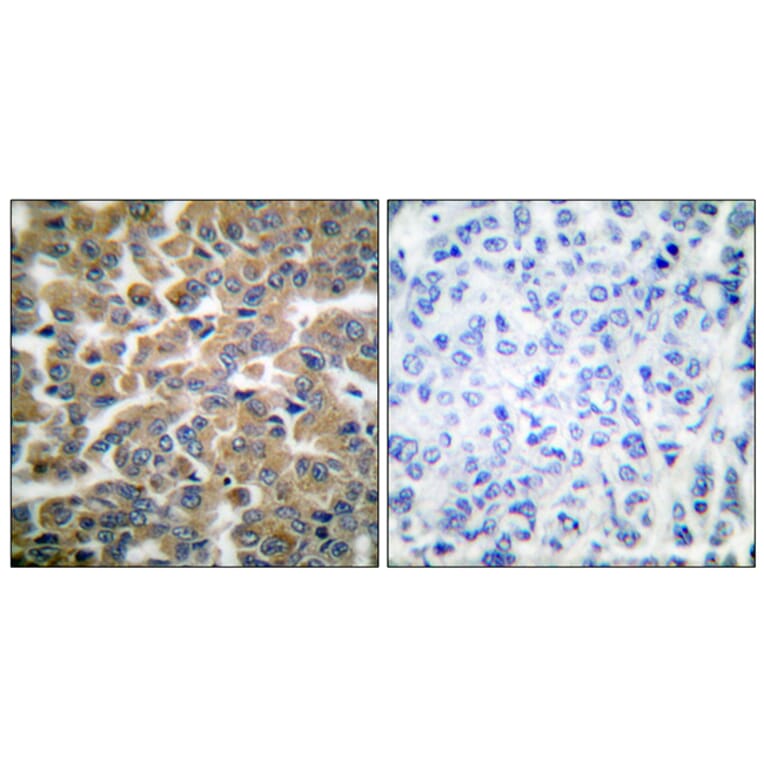 Immunohistochemistry - Anti-GR Antibody (B0073) - Antibodies.com