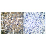 Immunohistochemistry - Anti-GR Antibody (B0073) - Antibodies.com