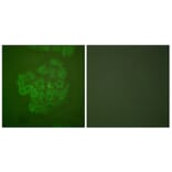 Immunofluorescence - Anti-GR Antibody (B0073) - Antibodies.com
