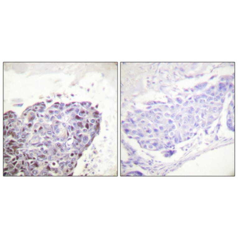 Immunohistochemistry - Anti-GR Antibody (B0073) - Antibodies.com