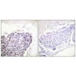Immunohistochemistry - Anti-GR Antibody (B0073) - Antibodies.com