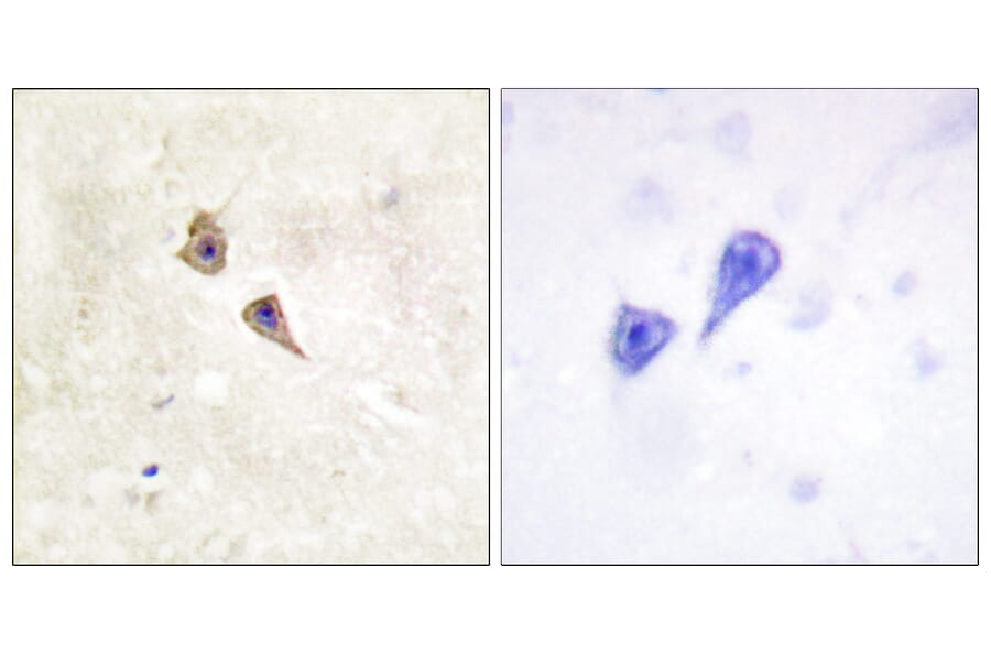 Immunohistochemistry - Anti-Interferon alpha + beta Receptor alpha (phospho Tyr466) Antibody (A0952) - Antibodies.com