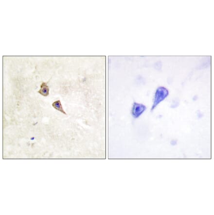 Immunohistochemistry - Anti-Interferon alpha + beta Receptor alpha (phospho Tyr466) Antibody (A0952) - Antibodies.com