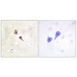 Immunohistochemistry - Anti-Interferon alpha + beta Receptor alpha (phospho Tyr466) Antibody (A0952) - Antibodies.com