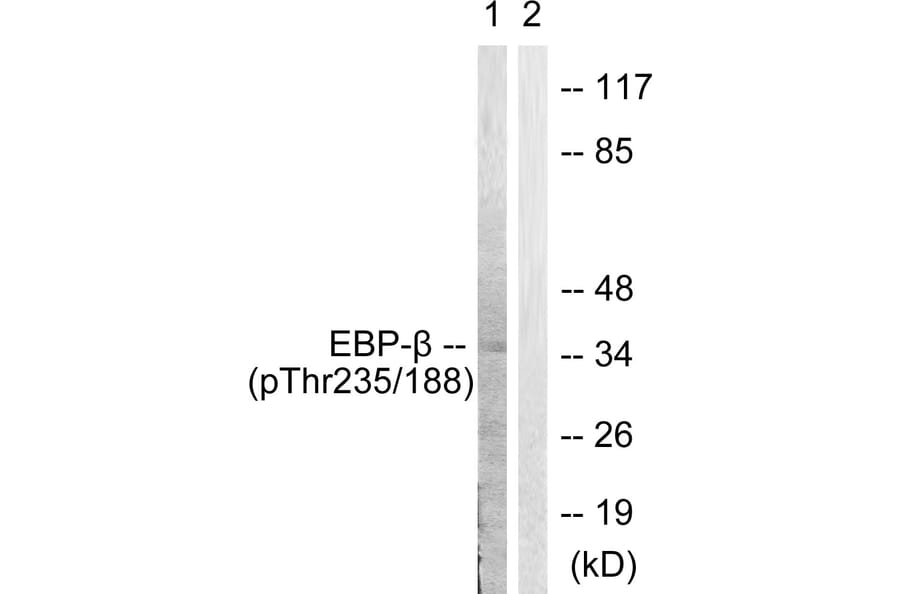 Western Blot - Anti-CEBP beta (phospho Thr235 + Thr188) Antibody (A0057) - Antibodies.com