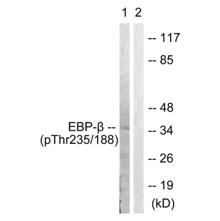 Western Blot - Anti-CEBP beta (phospho Thr235 + Thr188) Antibody (A0057) - Antibodies.com