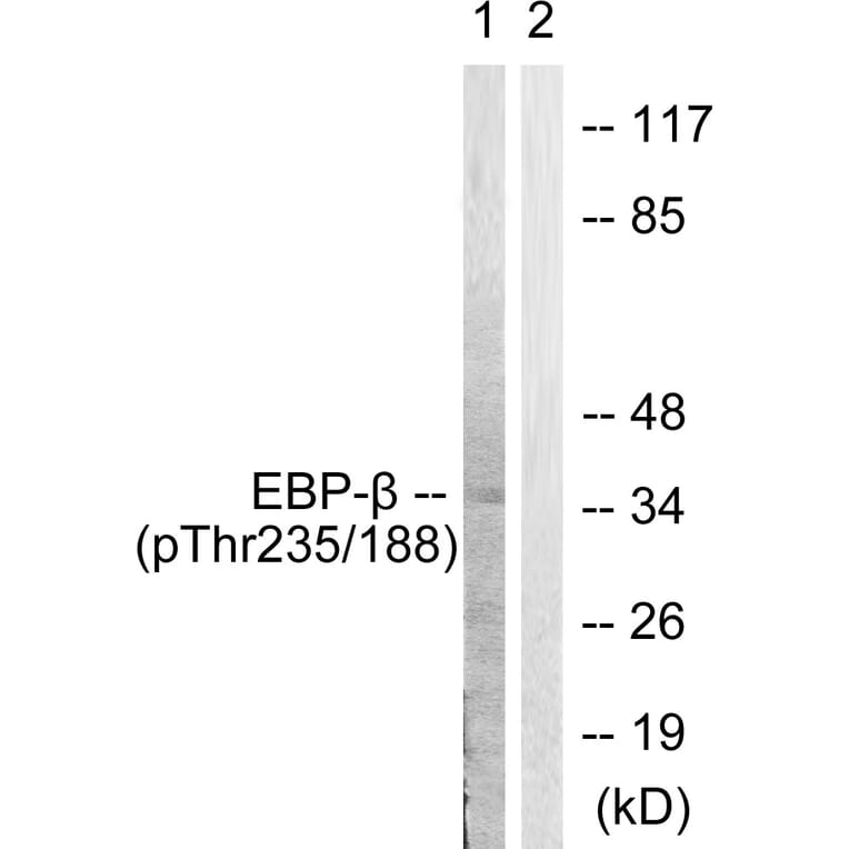 Western Blot - Anti-CEBP beta (phospho Thr235 + Thr188) Antibody (A0057) - Antibodies.com