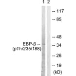 Western Blot - Anti-CEBP beta (phospho Thr235 + Thr188) Antibody (A0057) - Antibodies.com