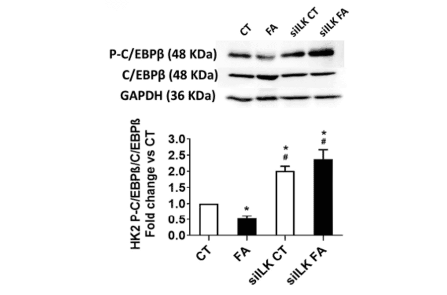 Validation Data - Anti-CEBP beta (phospho Thr235 + Thr188) Antibody (A95647)