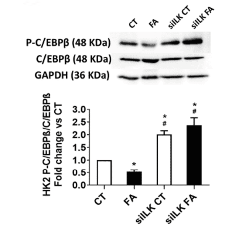 Validation Data - Anti-CEBP beta (phospho Thr235 + Thr188) Antibody (A95647)
