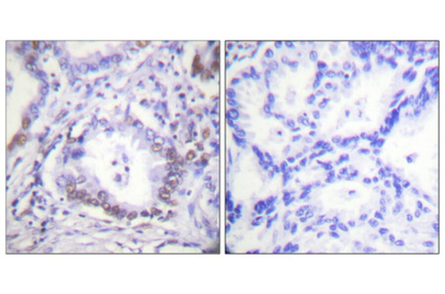Immunohistochemistry - Anti-CEBP beta (phospho Thr235 + Thr188) Antibody (A0057) - Antibodies.com