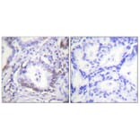 Immunohistochemistry - Anti-CEBP beta (phospho Thr235 + Thr188) Antibody (A0057) - Antibodies.com