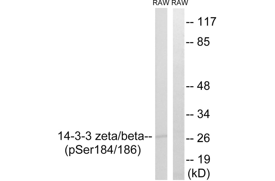 Western Blot - Anti-14-3-3 beta + zeta (phospho Ser184 + Ser186) Antibody (A8001) - Antibodies.com
