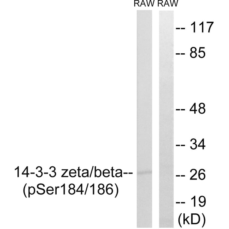 Western Blot - Anti-14-3-3 beta + zeta (phospho Ser184 + Ser186) Antibody (A8001) - Antibodies.com
