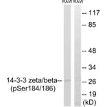 Western Blot - Anti-14-3-3 beta + zeta (phospho Ser184 + Ser186) Antibody (A8001) - Antibodies.com