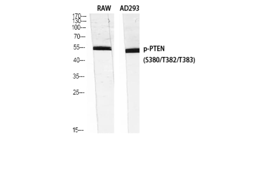 Western Blot - Anti-PTEN (phospho Ser380 + Thr382 + Thr383) Antibody (A7203) - Antibodies.com