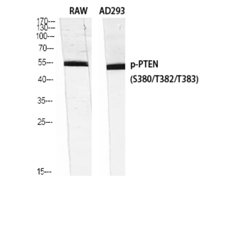 Western Blot - Anti-PTEN (phospho Ser380 + Thr382 + Thr383) Antibody (A7203) - Antibodies.com