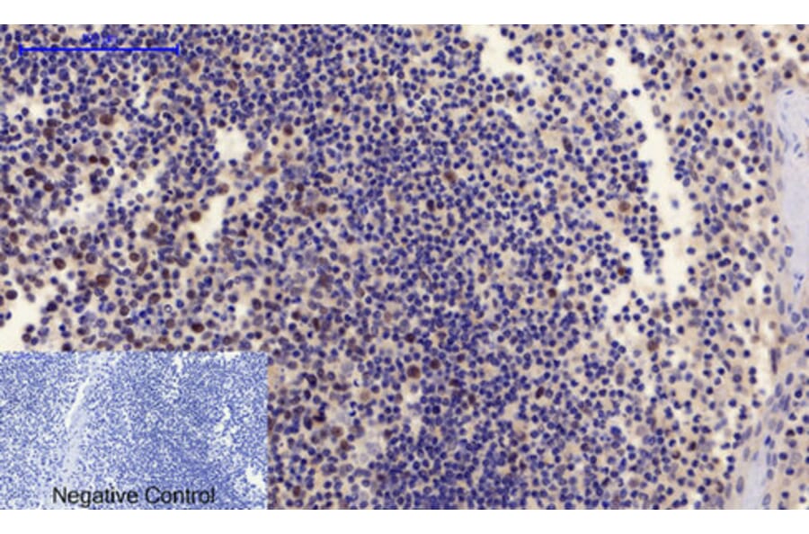 Immunohistochemistry - Anti-PTEN (phospho Ser380 + Thr382 + Thr383) Antibody (A7203) - Antibodies.com