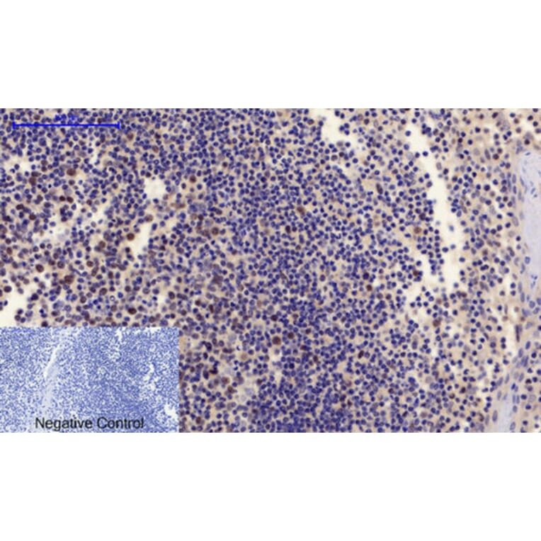 Immunohistochemistry - Anti-PTEN (phospho Ser380 + Thr382 + Thr383) Antibody (A7203) - Antibodies.com