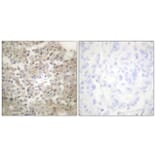 Immunohistochemistry - Anti-Tryptophan Hydroxylase (phospho Ser260) Antibody (A1012) - Antibodies.com