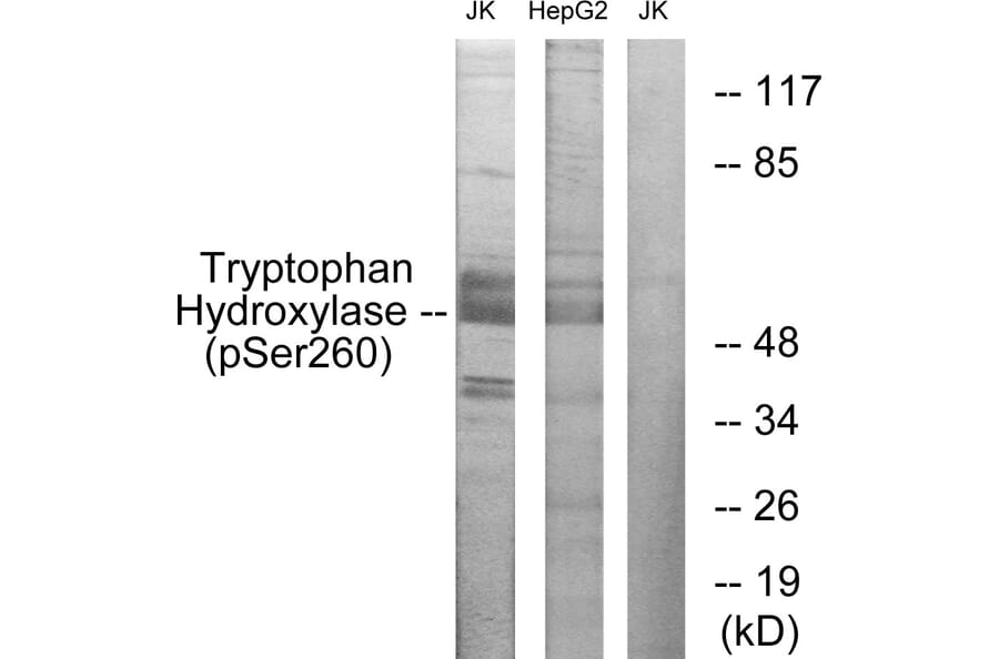Western Blot - Anti-Tryptophan Hydroxylase (phospho Ser260) Antibody (A1012) - Antibodies.com