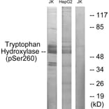 Western Blot - Anti-Tryptophan Hydroxylase (phospho Ser260) Antibody (A1012) - Antibodies.com