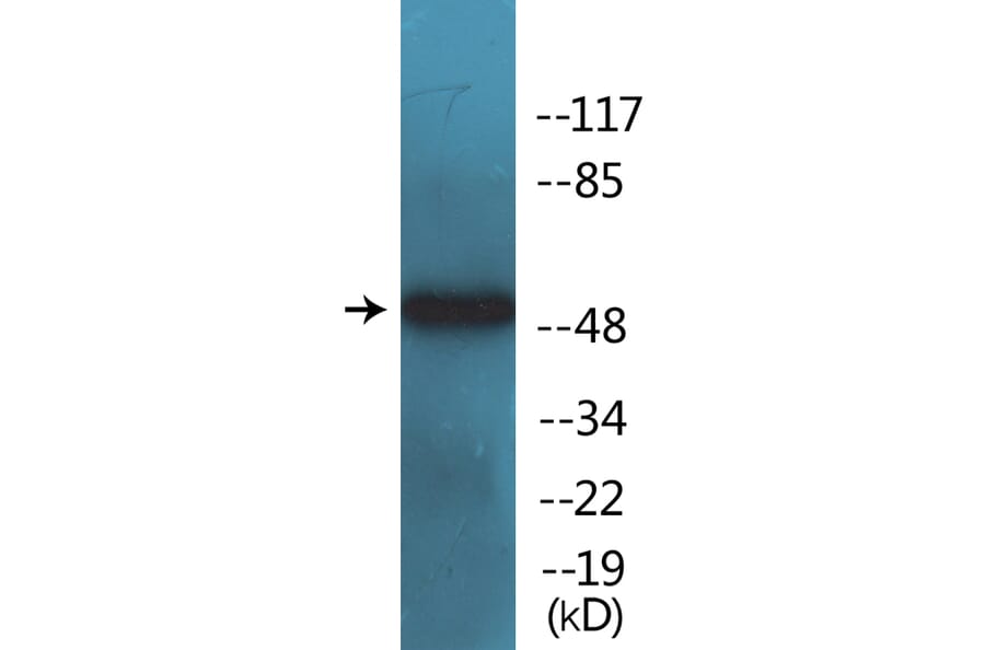Western Blot - Anti-Tryptophan Hydroxylase (phospho Ser260) Antibody (P12-1195) - Antibodies.com