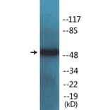 Western Blot - Anti-Tryptophan Hydroxylase (phospho Ser260) Antibody (P12-1195) - Antibodies.com