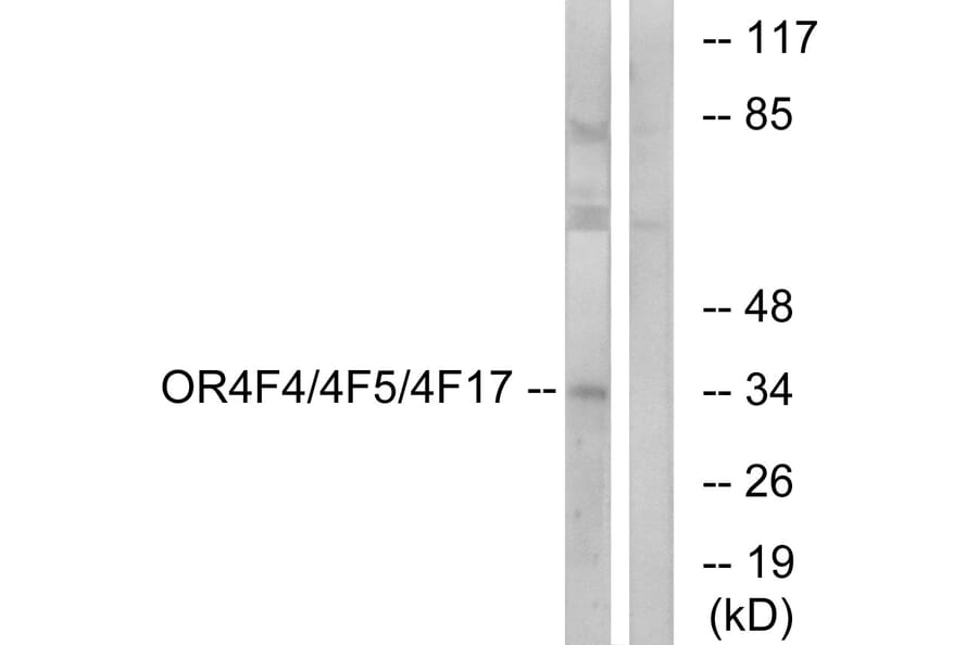 Western Blot - Anti-OR4F4 + OR4F5 + OR4F17 Antibody (G444) - Antibodies.com