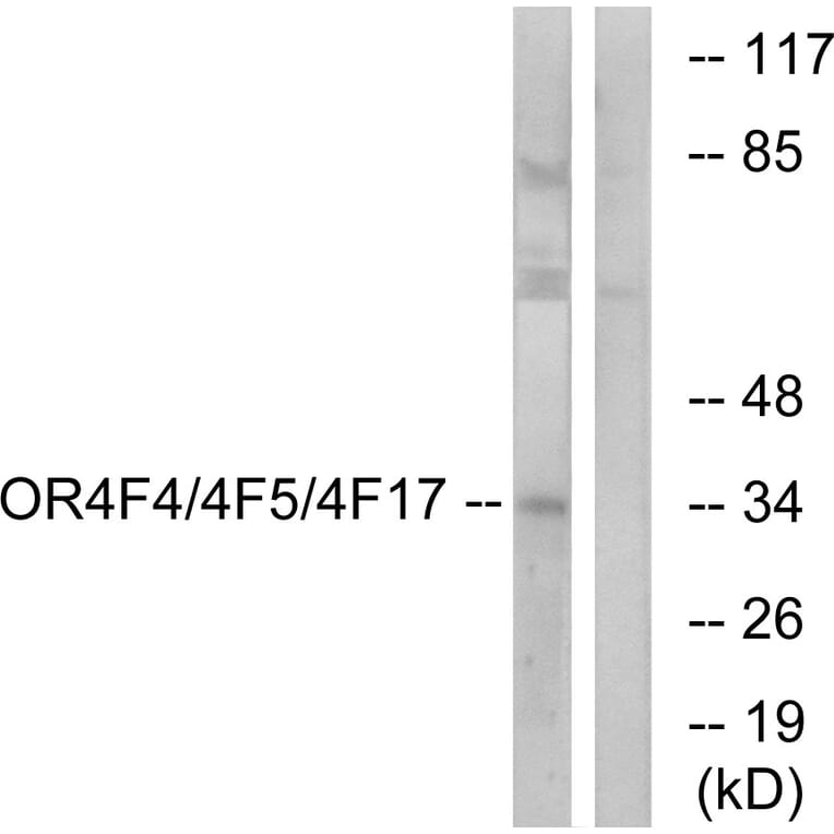 Western Blot - Anti-OR4F4 + OR4F5 + OR4F17 Antibody (G444) - Antibodies.com