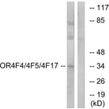 Western Blot - Anti-OR4F4 + OR4F5 + OR4F17 Antibody (G444) - Antibodies.com