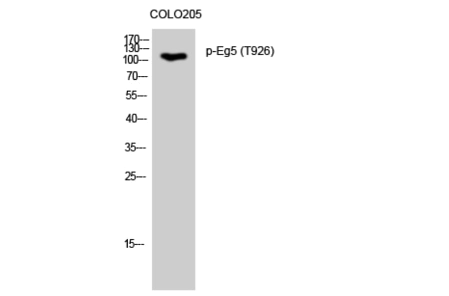 Western Blot - Anti-KIF11 (phospho Thr926) Antibody (A1081) - Antibodies.com