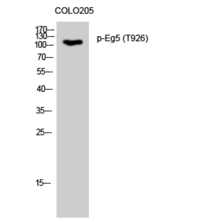 Western Blot - Anti-KIF11 (phospho Thr926) Antibody (A1081) - Antibodies.com