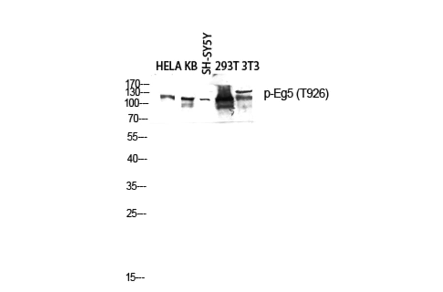 Western Blot - Anti-KIF11 (phospho Thr926) Antibody (A1081) - Antibodies.com