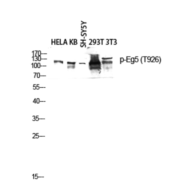 Western Blot - Anti-KIF11 (phospho Thr926) Antibody (A1081) - Antibodies.com