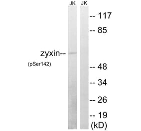 Western Blot - Anti-Zyxin (phospho Ser142) Antibody (A8453) - Antibodies.com