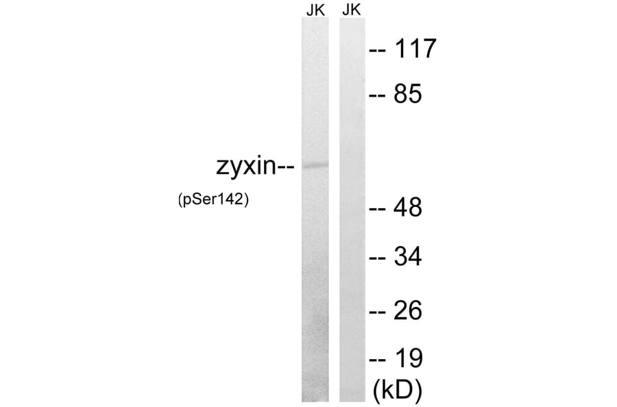 Western Blot - Anti-Zyxin (phospho Ser142) Antibody (A8453) - Antibodies.com