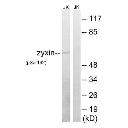 Western Blot - Anti-Zyxin (phospho Ser142) Antibody (A8453) - Antibodies.com