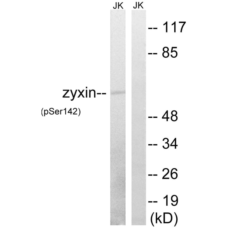 Western Blot - Anti-Zyxin (phospho Ser142) Antibody (A8453) - Antibodies.com