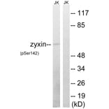Western Blot - Anti-Zyxin (phospho Ser142) Antibody (A8453) - Antibodies.com