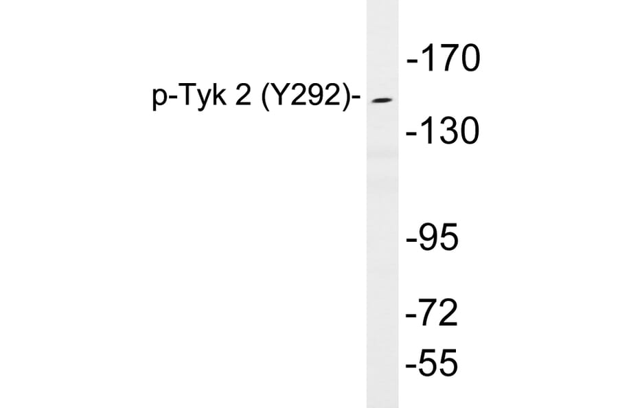 Western Blot - Anti-Tyk 2 (phospho Tyr292) Antibody (P12-1064) - Antibodies.com