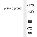 Western Blot - Anti-Tyk 2 (phospho Tyr292) Antibody (P12-1064) - Antibodies.com